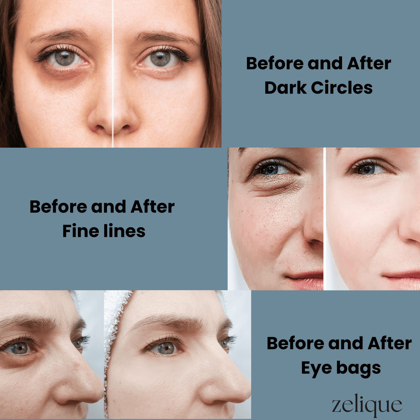 RejuvenEyes  Light Therapy